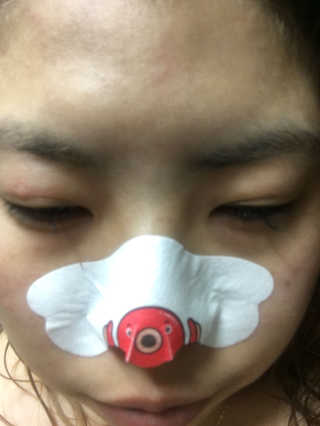나이팅게일 TAKO PACK NOSE [문어코팩] — 4점을 준 리뷰어가 2017년 4월 올린 사용 사진