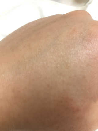 네이처컬렉션 예화담 퍼스트 트리트먼트 에센스 — 5점을 준 리뷰어가 2020년 1월 올린 사용 사진