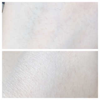 시카고 시카 더블 이펙트 앰플 30ml 기획세트 — 5점을 준 리뷰어가 2018년 8월 올린 사용 사진