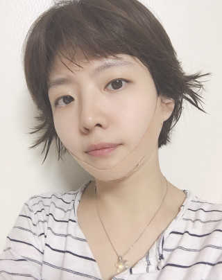 아이디플라코스메틱 아이디 페이스핏 마이너스 밴드 — 5점을 준 리뷰어가 2019년 12월 올린 사용 사진