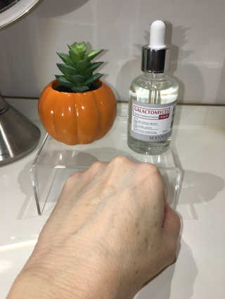 [마녀 공장] 발가락 토미 니아신 에센스 50ml — 5점을 준 리뷰어가 2018년 10월 올린 사용 사진