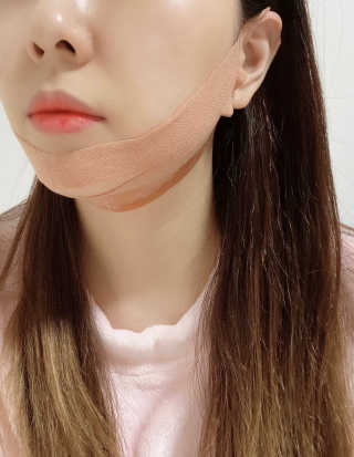 아이디플라코스메틱 아이디 페이스핏 마이너스 밴드 — 2점을 준 리뷰어가 2020년 3월 올린 사용 사진