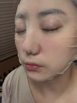 웰더마 차 이슬 티트리 수딩 앰플 마스크 — 5점을 준 리뷰어가 2019년 11월 올린 사용 사진