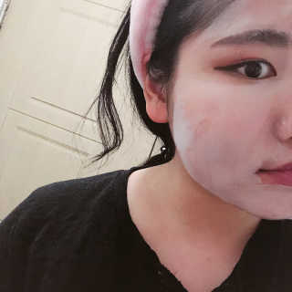 셀퓨전씨 트리악 포어 딜리트 버블 팩 — 5점을 준 리뷰어가 2018년 4월 올린 사용 사진