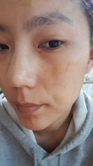 보타니티 [홍]조[진]정[결]케어 플라본 세럼 — 4.33점을 준 리뷰어가 2018년 5월 올린 사용 사진