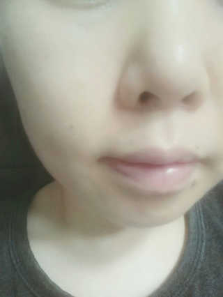 23years old 에어레이닉 포어 마스크 — 4점을 준 리뷰어가 2018년 5월 올린 사용 사진