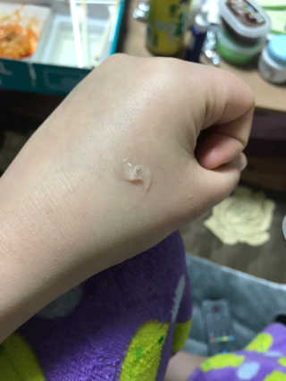 아이소이 파란소화기 응급스팟 — 4.33점을 준 리뷰어가 2018년 3월 올린 사용 사진