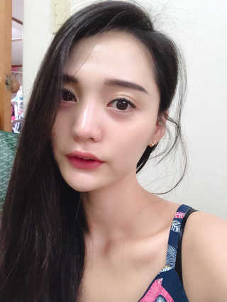 메디페르루테인앰플 3종 — 5점을 준 리뷰어가 2019년 8월 올린 사용 사진