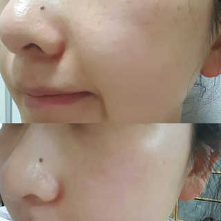 셀라피 에이리페어플러스크림 — 4점을 준 리뷰어가 2018년 4월 올린 사용 사진