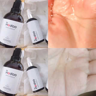 닥터모두 홈스파 스칼프 샴푸 300ml + 헤어토닉 — 5점을 준 리뷰어가 2019년 2월 올린 사용 사진