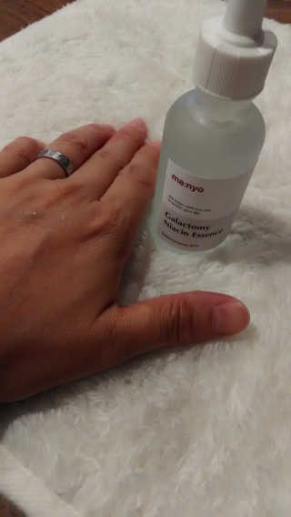 [마녀 공장] 발가락 토미 니아신 에센스 50ml — 5점을 준 리뷰어가 2019년 6월 올린 사용 사진