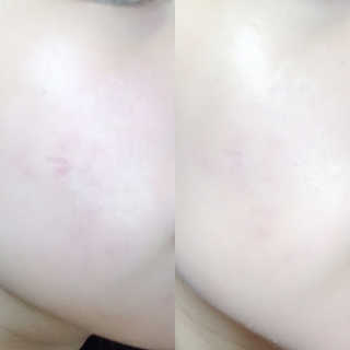 딸기❤️님이 올린 리뷰 사진 2
