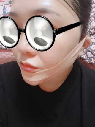 아이디플라코스메틱 아이디 페이스핏 마이너스 밴드 — 5점을 준 리뷰어가 2019년 11월 올린 사용 사진