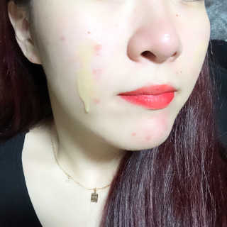 보타니티 [홍]조[진]정[결]케어 플라본 세럼 — 5점을 준 리뷰어가 2018년 5월 올린 사용 사진