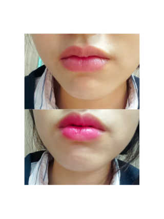 눈터님이 올린 리뷰 사진 2