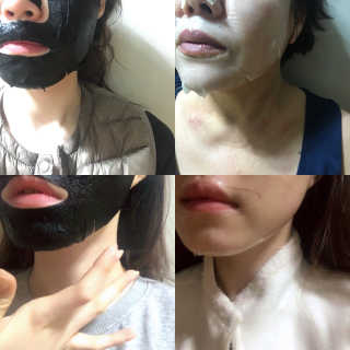 [더마허브] 주사팩 5종, 물광,백옥,태반,신데렐라 등 — 4.17점을 준 리뷰어가 2018년 3월 올린 사용 사진