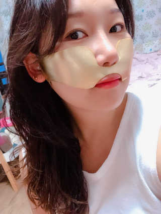 [스케덤] 상악밴드 — 4점을 준 리뷰어가 2019년 6월 올린 사용 사진