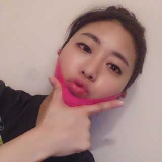 스케덤 펩타이드 리프팅밴드 — 5점을 준 리뷰어가 2019년 4월 올린 사용 사진