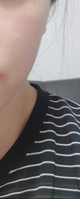 보타니티 [홍]조[진]정[결]케어 플라본 세럼 — 4점을 준 리뷰어가 2018년 5월 올린 사용 사진