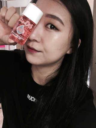Bio-oil(바이오오일) 바이오오일 — 5점을 준 리뷰어가 2016년 10월 올린 사용 사진
