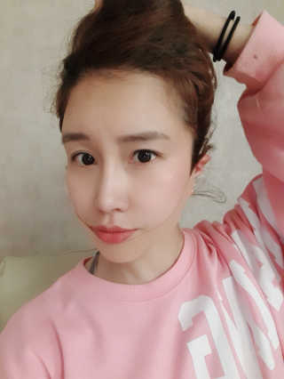 아이디플라코스메틱 아이디 페이스핏 마이너스 밴드 — 5점을 준 리뷰어가 2020년 3월 올린 사용 사진