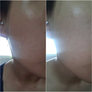 시카고 시카 더블 이펙트 앰플 30ml 기획세트 — 5점을 준 리뷰어가 2018년 8월 올린 사용 사진