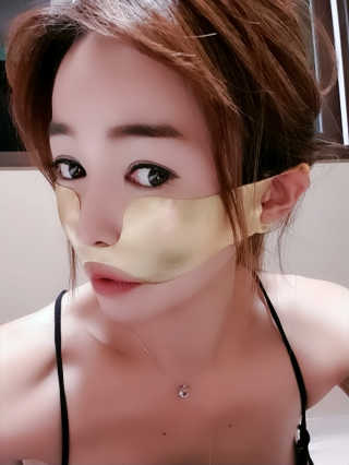 [스케덤] 상악밴드 — 5점을 준 리뷰어가 2019년 9월 올린 사용 사진