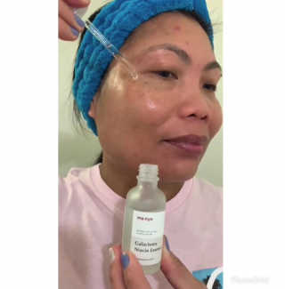 [마녀 공장] 발가락 토미 니아신 에센스 50ml — 5점을 준 리뷰어가 2019년 4월 올린 사용 사진
