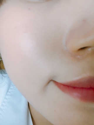 보타니티 [홍]조[진]정[결]케어 플라본 세럼 — 4.17점을 준 리뷰어가 2018년 5월 올린 사용 사진