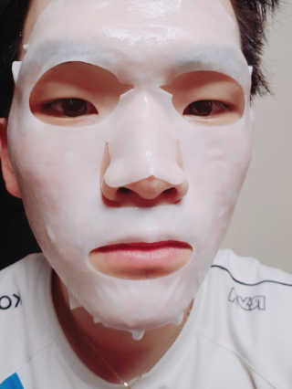 [더마허브] 주사팩 5종, 물광,백옥,태반,신데렐라 등 — 5점을 준 리뷰어가 2018년 2월 올린 사용 사진