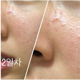 고은님이 올린 리뷰 사진 2