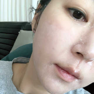 쏘내추럴 핑크 머드 마스크 5매 — 4점을 준 리뷰어가 2019년 11월 올린 사용 사진