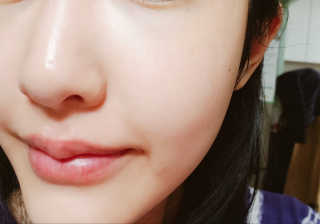 미플레이 진짜 티트리 토너 패드 — 4.67점을 준 리뷰어가 2018년 11월 올린 사용 사진