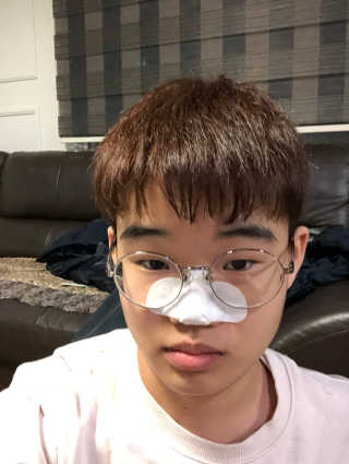 미팩토리 3단 돼지코팩 3매입 X 2 — 4점을 준 리뷰어가 2018년 2월 올린 사용 사진