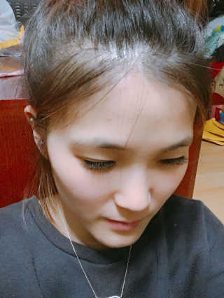 다슈코리아 다슈 데일리 헤어라인 커버 쿠션 — 2.67점을 준 리뷰어가 2017년 5월 올린 사용 사진