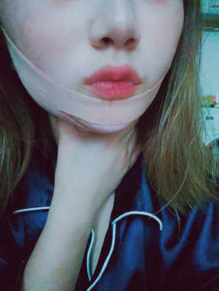 아이디플라코스메틱 아이디 페이스핏 마이너스 밴드 — 5점을 준 리뷰어가 2019년 10월 올린 사용 사진