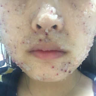 23years old 아쿠아밥 모델링 마스크 — 4점을 준 리뷰어가 2017년 4월 올린 사용 사진