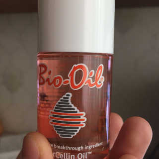 Bio-oil(바이오오일) 바이오오일 — 3점을 준 리뷰어가 2016년 10월 올린 사용 사진