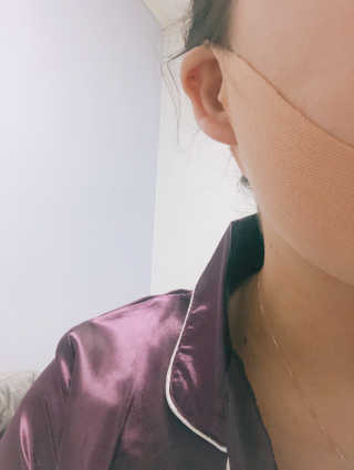 아이디플라코스메틱 아이디 페이스핏 마이너스 밴드 — 3점을 준 리뷰어가 2019년 9월 올린 사용 사진