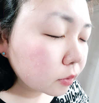 타임인네이처 [더메디닥터] 카렌듈라 엔자임 필링젤 — 4점을 준 리뷰어가 2019년 2월 올린 사용 사진
