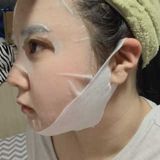 스케덤 클루덤 리프팅 패치 — 5점을 준 리뷰어가 2019년 3월 올린 사용 사진