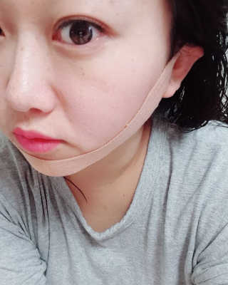 아이디플라코스메틱 아이디 페이스핏 마이너스 밴드 — 5점을 준 리뷰어가 2019년 9월 올린 사용 사진