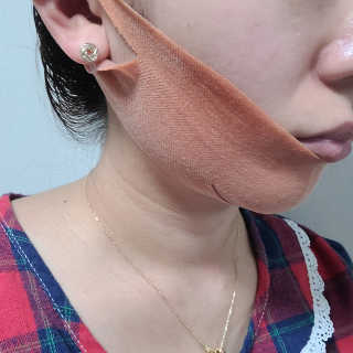 아이디플라코스메틱 아이디 페이스핏 마이너스 밴드 — 5점을 준 리뷰어가 2020년 4월 올린 사용 사진