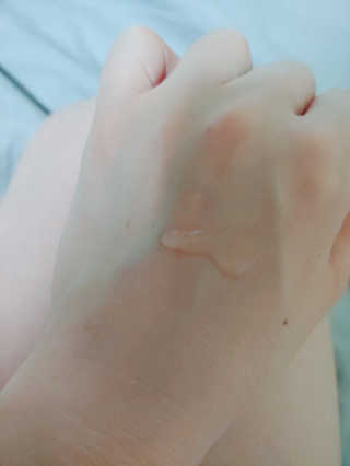 [스킨큐어] 산다화 비타민C 화이트닝 에센스 30ml — 5점을 준 리뷰어가 2019년 7월 올린 사용 사진