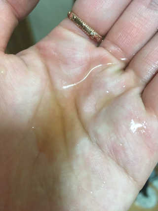 보타메디 씨놀®미라클마스크팩 — 5점을 준 리뷰어가 2018년 11월 올린 사용 사진