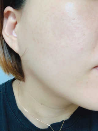 mylovehyunji님이 올린 리뷰 사진 2