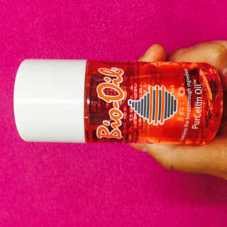 Bio-oil(바이오오일) 바이오오일(Bio-oil) — 3.5점을 준 리뷰어가 2017년 1월 올린 사용 사진