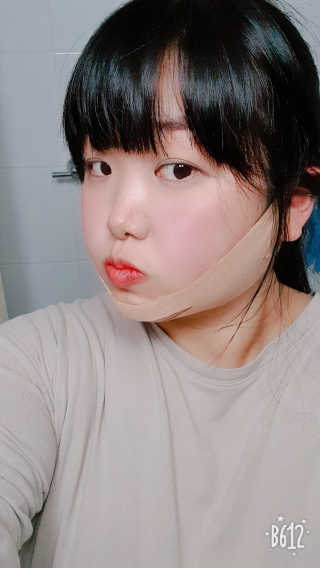 아이디플라코스메틱 아이디 페이스핏 마이너스 밴드 — 5점을 준 리뷰어가 2019년 11월 올린 사용 사진