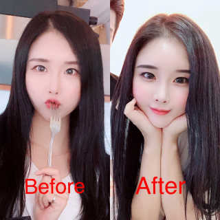 [크리산]  모근.모발강화 악티프 토닉 — 5점을 준 리뷰어가 2019년 10월 올린 사용 사진
