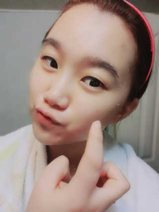타임인네이처 [더메디닥터] 카렌듈라 엔자임 필링젤 — 4점을 준 리뷰어가 2019년 2월 올린 사용 사진